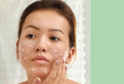 GEL PURIFIANT LE GESTE NATUREL POUR L'ACNE